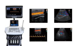 <b>【多維彩超】四維彩超機(jī),三維,二維的彩超機(jī)區(qū)別</b>